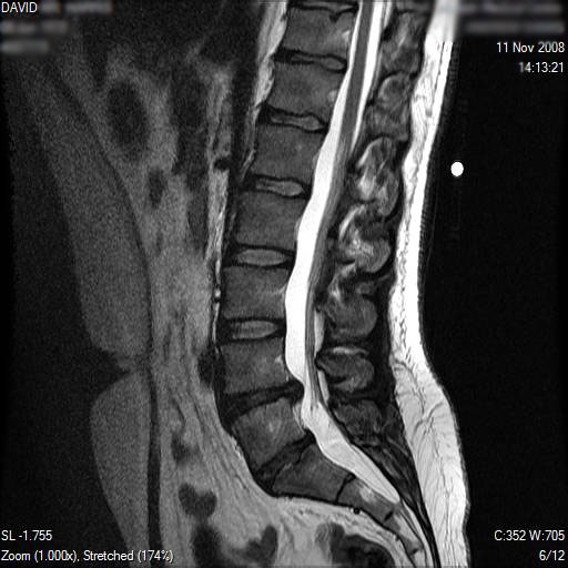 DavidH MRI Scans